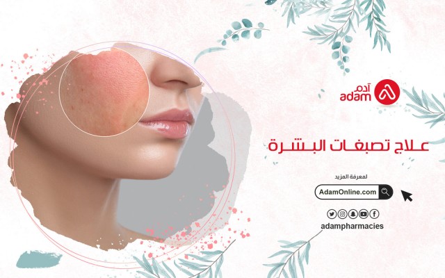 علاج تصبغات البشرة